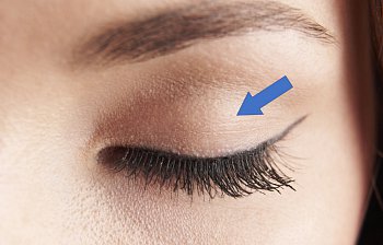 eyelid