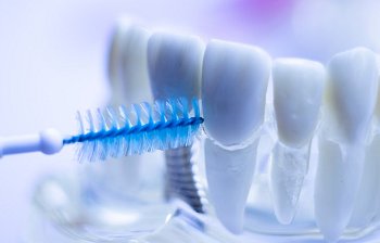 interdental