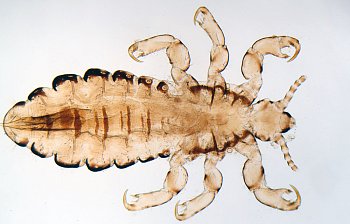 louse