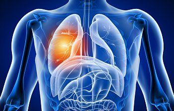 lung