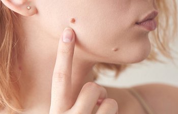 mole