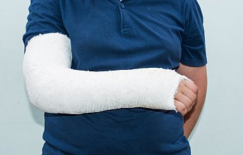 cast