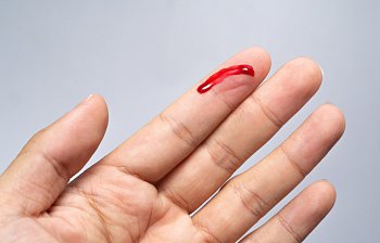 bleeding