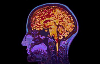 brain
