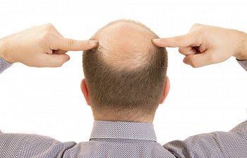 bald