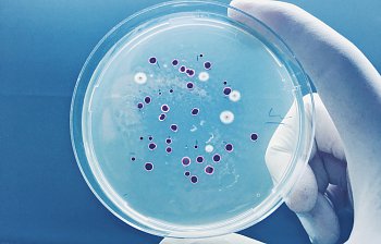 bacteria
