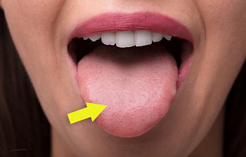 tongue