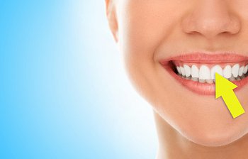 tooth