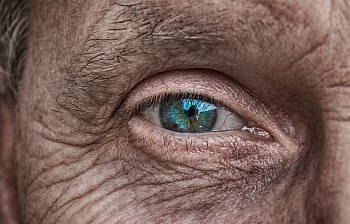 wrinkle